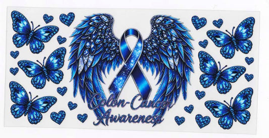 Colon - Cancer